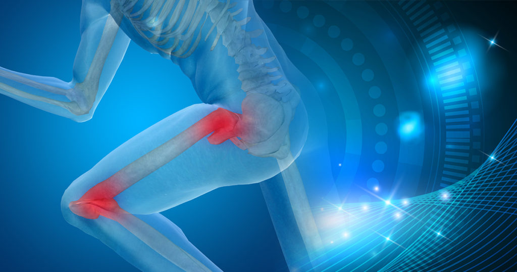 Top Tips to Alleviate Painful Symptoms of Arthritis