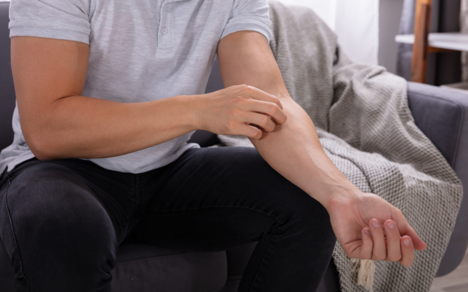 The Best Soaps for Psoriasis